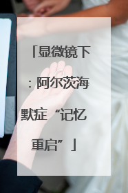 显微镜下：阿尔茨海默症“记忆重启”